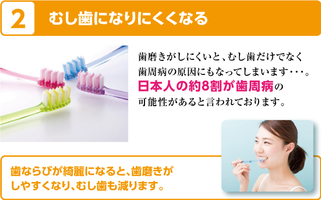 むし歯になりにくくなる／歯磨きがしにくいと、むし歯だけでなく歯周病の原因にもなってしまいます・・・。日本人の約8割が歯周病の可能性があると言われています。歯並びが綺麗になると、歯磨きがしやすくなり、むし歯も減ります。